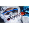 SCIENCE FRAUD: Florida Gov. DeSantis calls for investigation into why people are testing "positive" for coronavirus tests they never received
