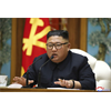 Revered Leader Kim Jong Un may be in "grave danger" after surgery - we hope it not lead to real grave!