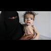 Yemeni Journalist: Saudi Arabia's Total Blockade on Yemen is "Death Sentence" for All