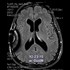 Why is the mainstream media not covering this neuroscientist's open source medical case study? 